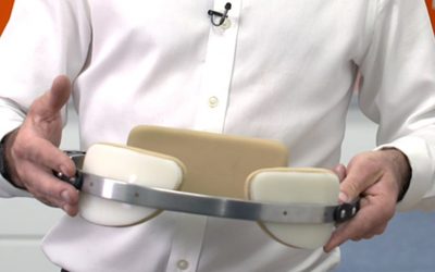 Early experience in bracing for pectus carinatum deformity; a viable alternative to surgery